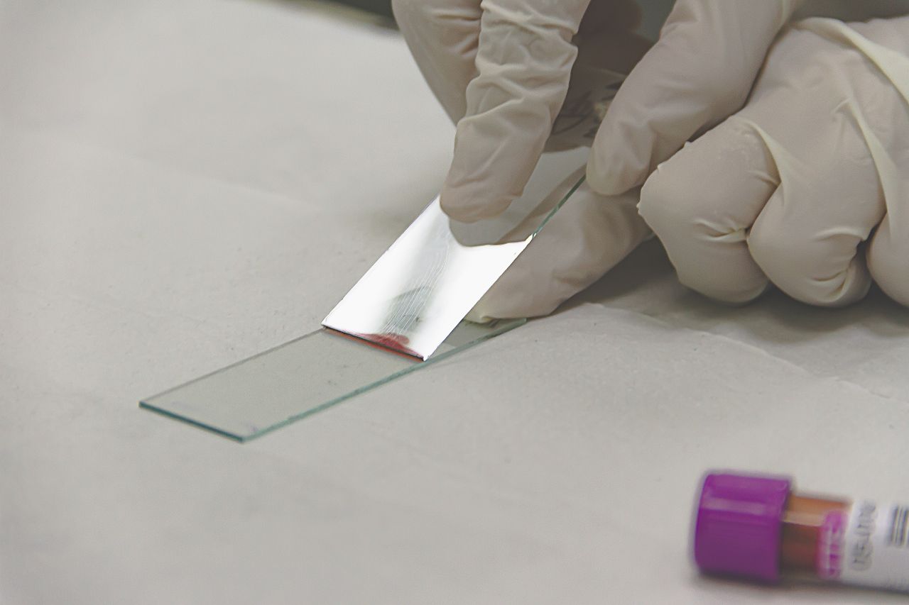 Scientist in gloves preparing a glass slide with a sample for microscopic analysis.
